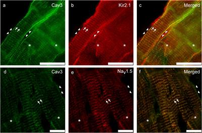 Caveolin-3 Microdomain: Arrhythmia Implications for Potassium Inward Rectifier and Cardiac Sodium Channel